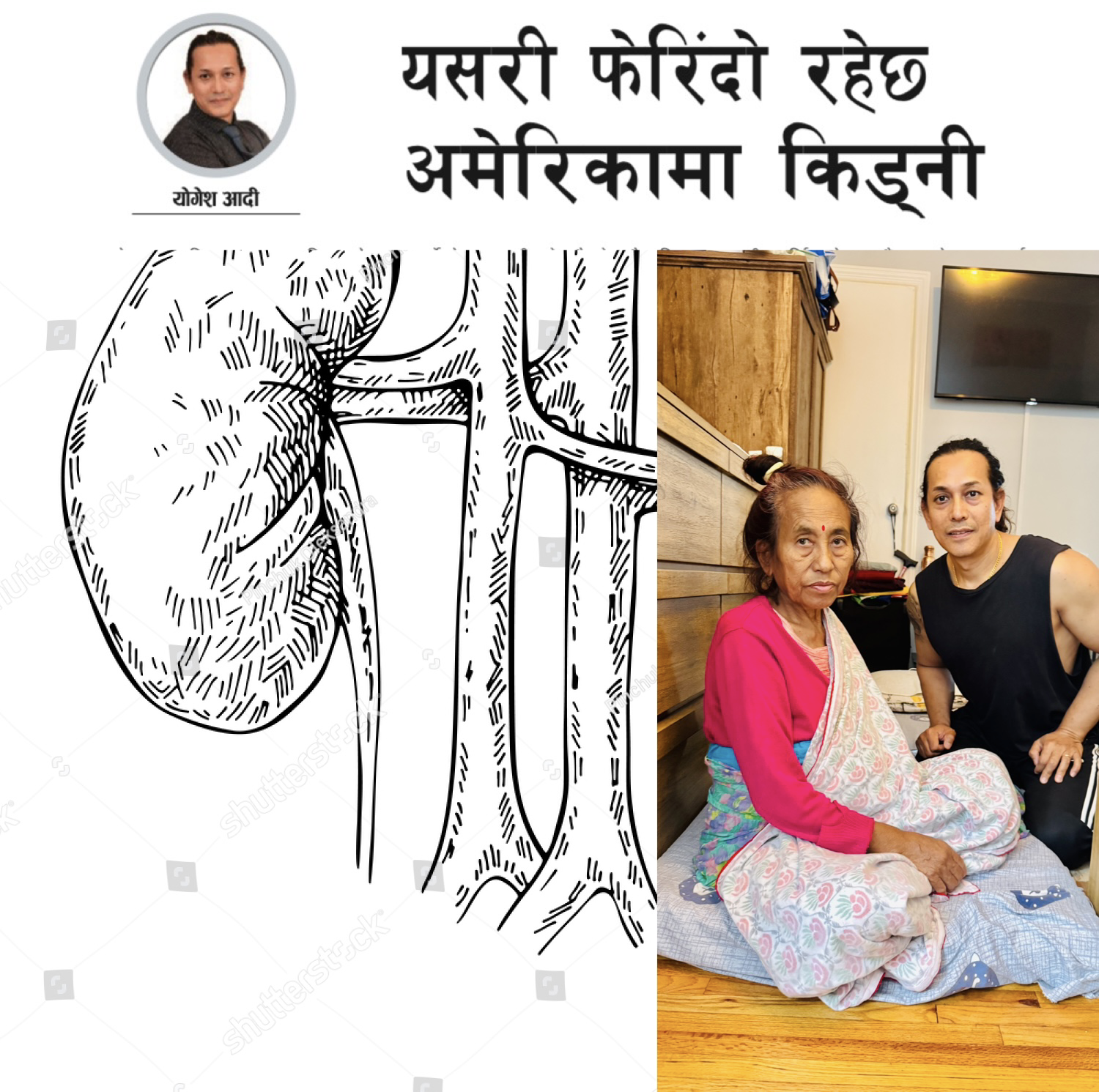 यसरी फेरिंदो रहेछ अमेरिकामा किड्नी